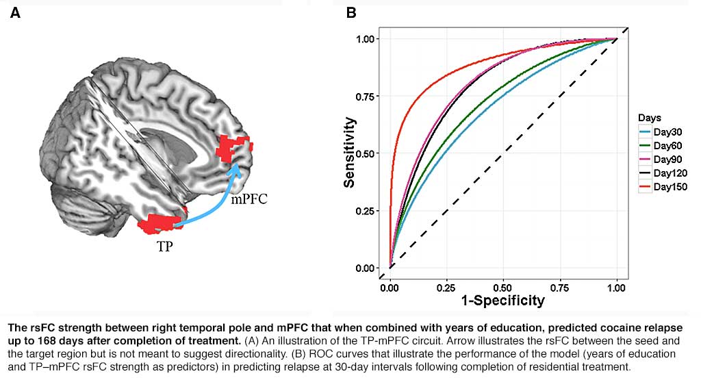 Salience and default mode network dysregulation in chronic cocaine users predict treatment outcome.