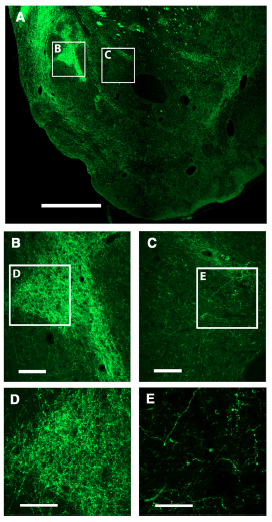 Local Control of Extracellular Dopamine Levels in the Medial Nucleus Accumbens by a Glutamatergic Projection from the Infralimbic Cortex.