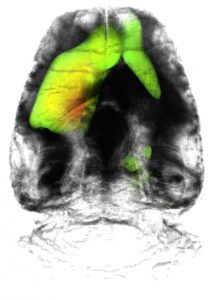 An image of a rat brain.