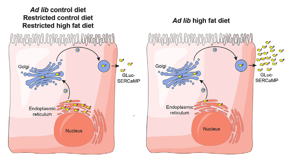 High fat diet disrupts endoplasmic reticulum calcium homeostasis in the rat liver.