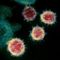 Electron microscope image of Covid-19 Virus