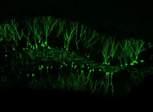 Hippocampus new born neurons (Confocal image taken with the Olympus FV1000 Confcoal Microscope)