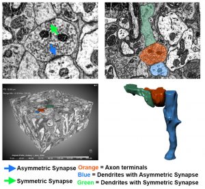 3-D reconstruction of a single axon terminal in the lateral habenula establishing asymmetric and symmetric synapses (SEM 3D image visualized with the DragonFly software)