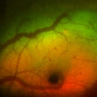 A portion of a figure from this study