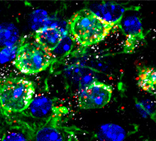 hotp-1-26-220 A histological image from this study