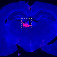Brain histology image from this article
